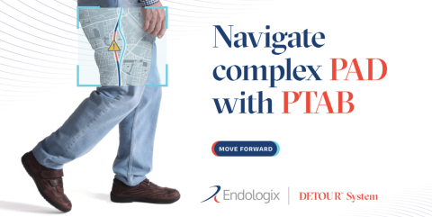 A photo featuring a person's legs overlaid with an illustrated map to represent interventional treatment of vascular disease.